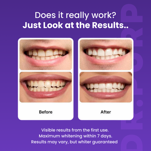 DRPURP Whitening Strip